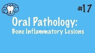 Odontogenic Keratocyst  Clinical Radiographic and Histopathologic Features [upl. by Xavler]