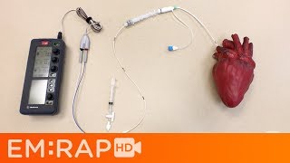 Placing a Transvenous Pacemaker [upl. by Kussell]