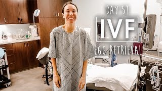 IVF Egg Retrieval Procedure  Patient is AWAKE [upl. by Ranzini]