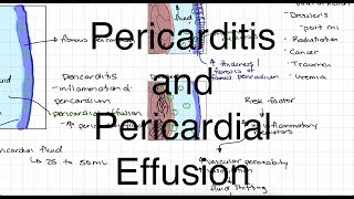 Histopathology HeartAcute fibrinous pericarditis [upl. by Kevyn78]