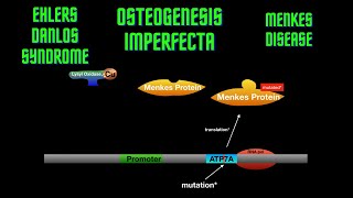 USMLE Step 1  Lesson 23  Osteogenesis Imperfecta Ehlers Danlos Syndrome and Menkes disease [upl. by Anelehs]