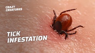 WARNING The Most Horrific Tick Infestations [upl. by Beryle677]