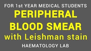 PERIPHERAL BLOOD SMEAR  LEISHMAN STAIN  HAEMATOLOGY LAB  PHYSIOLOGY [upl. by Tana]