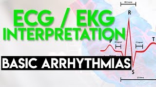 ECG Interpretation Tutorial  ChalkTalk 08  Basic Level [upl. by Silecara513]