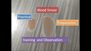 Blood Smear preparation staining and observation [upl. by Fischer672]