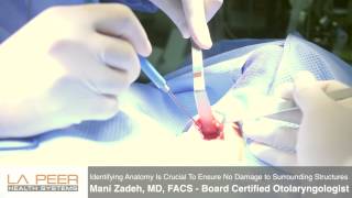 Watch Parathyroidectomy Surgery Performed by Dr Zadeh at La Peer Surgery Center [upl. by Murtha]