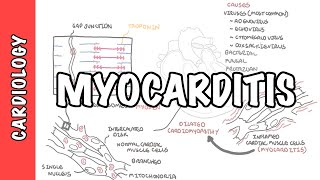 Jugular Venous Pulsations in Constrictive Pericarditis [upl. by Christean847]