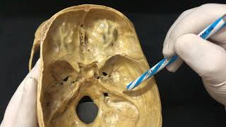 Skull Osteology  Cranial Cavity Anatomy [upl. by Culbert647]