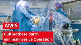 Hüftprothese durch minimalinvasive AMIS Methode  Live Operation [upl. by Atinid929]