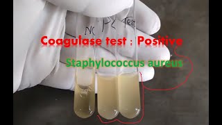 Coagulase test tube method observation [upl. by Marijo93]