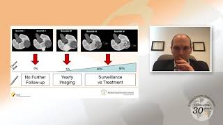 Small Renal Masses An Overview [upl. by Raynell893]