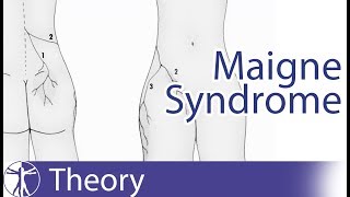 Thoracolumbar Syndrome  Maigne Syndrome [upl. by Loralie218]