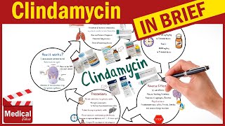 Clindamycin  Cleocin  What is Clindamycin Used For Dosage Side Effects amp Precautions [upl. by Newbold234]