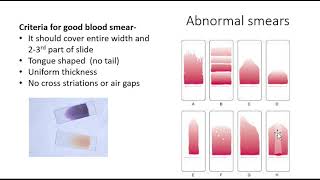 Blood smear amp Leishmans staining [upl. by Egerton799]