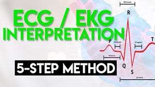 ECG Interpretation Made Easy  ECG EKG Interpretation Part 2 [upl. by Ylelhsa]