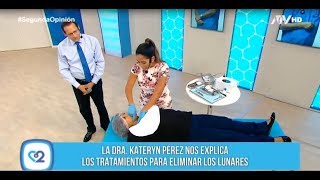 Extracción de Lunares  Clinica Continental [upl. by Alameda]