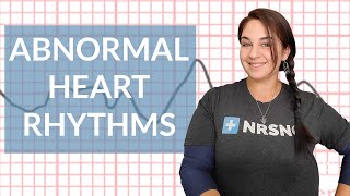 EKG like a BOSS Part 3  Abnormal Heart Rhythms [upl. by Ayihsa]