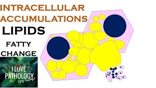 INTRACELLULAR ACCUMULATIONS LIPIDS Fatty Change [upl. by Malanie999]