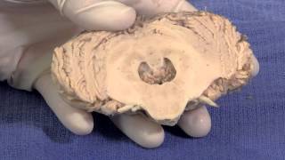 The Cerebellum Neuroanatomy Video Lab  Brain Dissections [upl. by Helms]