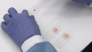 Making and staining blood smears [upl. by Eirot]