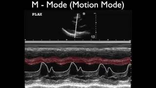 Ultrasound Physics Scanning Modes M Mode [upl. by Messab]