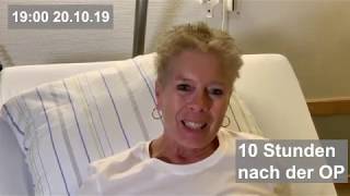 Hüftprothese durch minimalinvasive AMIS Methode  Live Operation [upl. by Ehcropal]