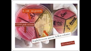 Mannitol salt agar  Staphylococcus aureus  MSA [upl. by Nileak664]